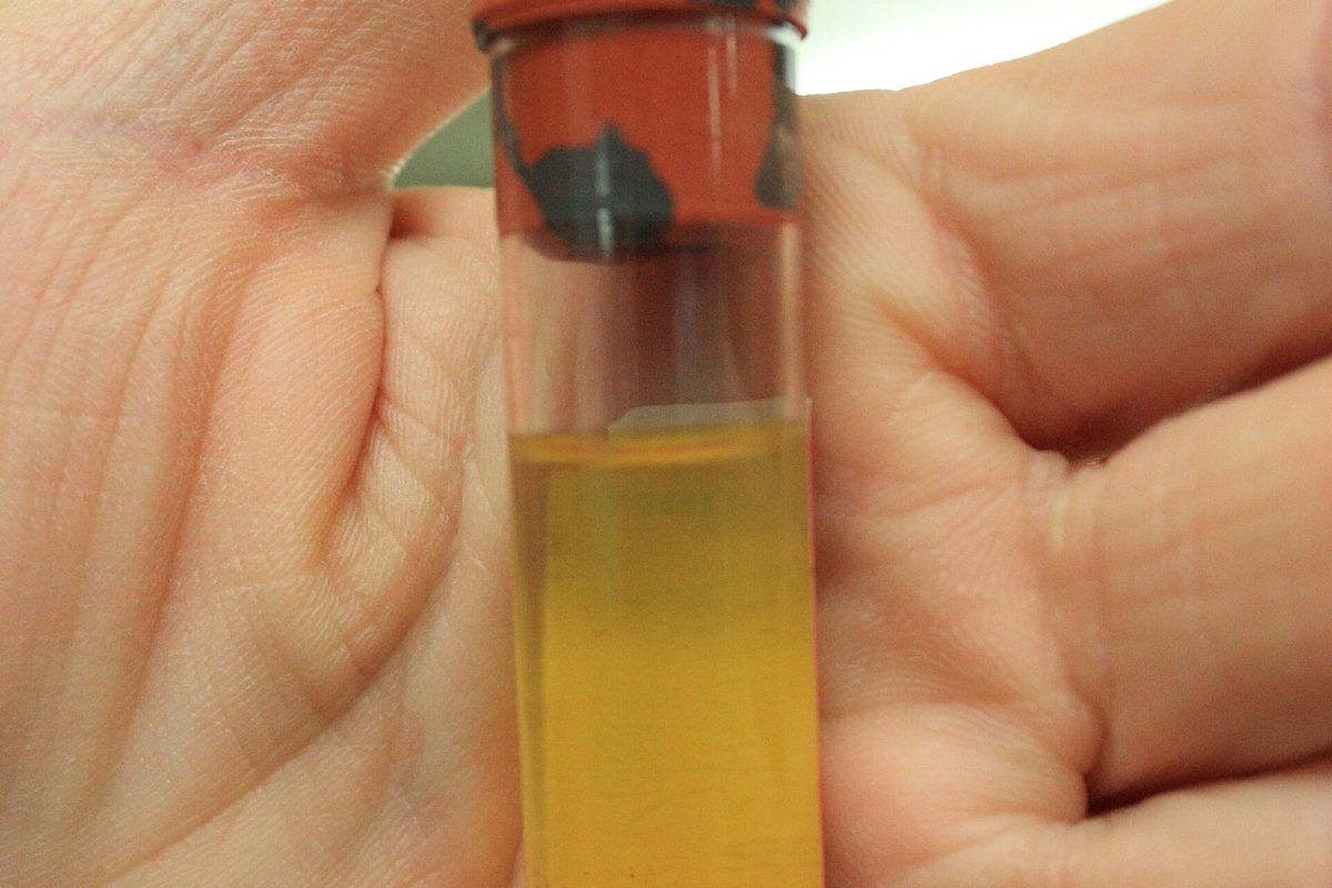 Primer plano de una mano sosteniendo un tubo de ensayo con sangre separada en capas de distintos colores