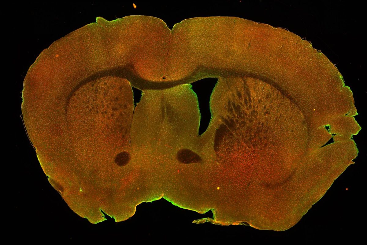 Imagen de microscopía de fluorescencia de un corte coronal de cerebro de ratón, con neuronas marcadas en verde y microglía en rojo sobre fondo negro