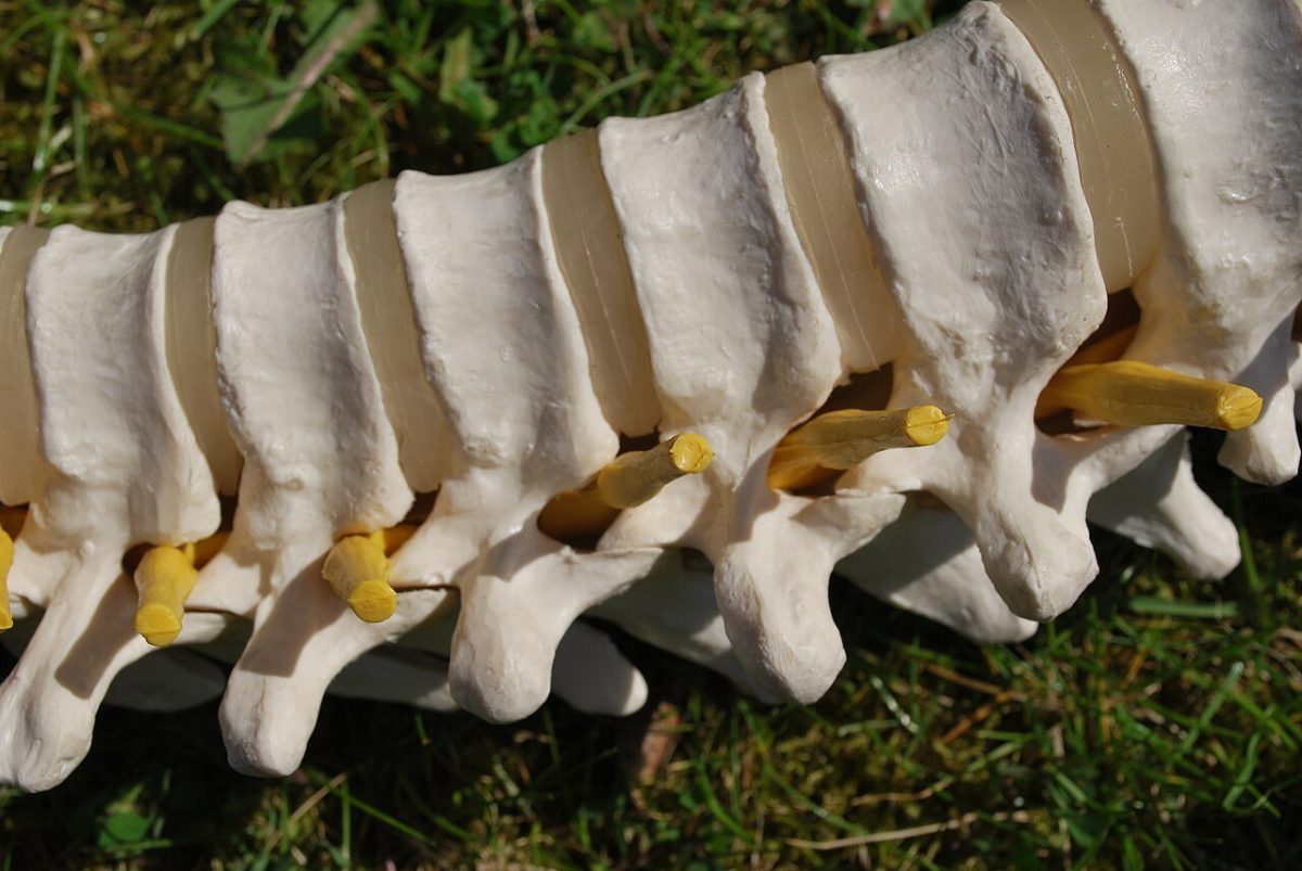 Primer plano de un modelo anatómico de vértebras mostrando las raíces nerviosas amarillas que emergen de la columna