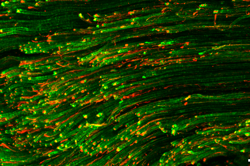 Imagen de microscopía de fluorescencia que muestra fibras nerviosas mielinizadas y no mielinizadas en tonos verdes y rojos