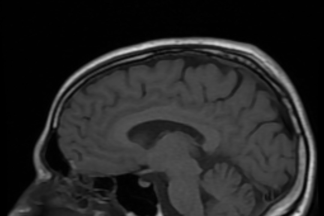 Imagen de resonancia magnética del cerebro humano en corte sagital, en escala de grises