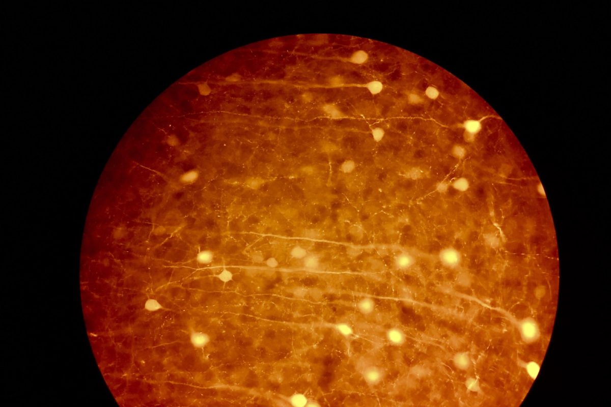 Campo circular de microscopio mostrando neuronas brillantes en tonos naranjas y dorados sobre fondo oscuro