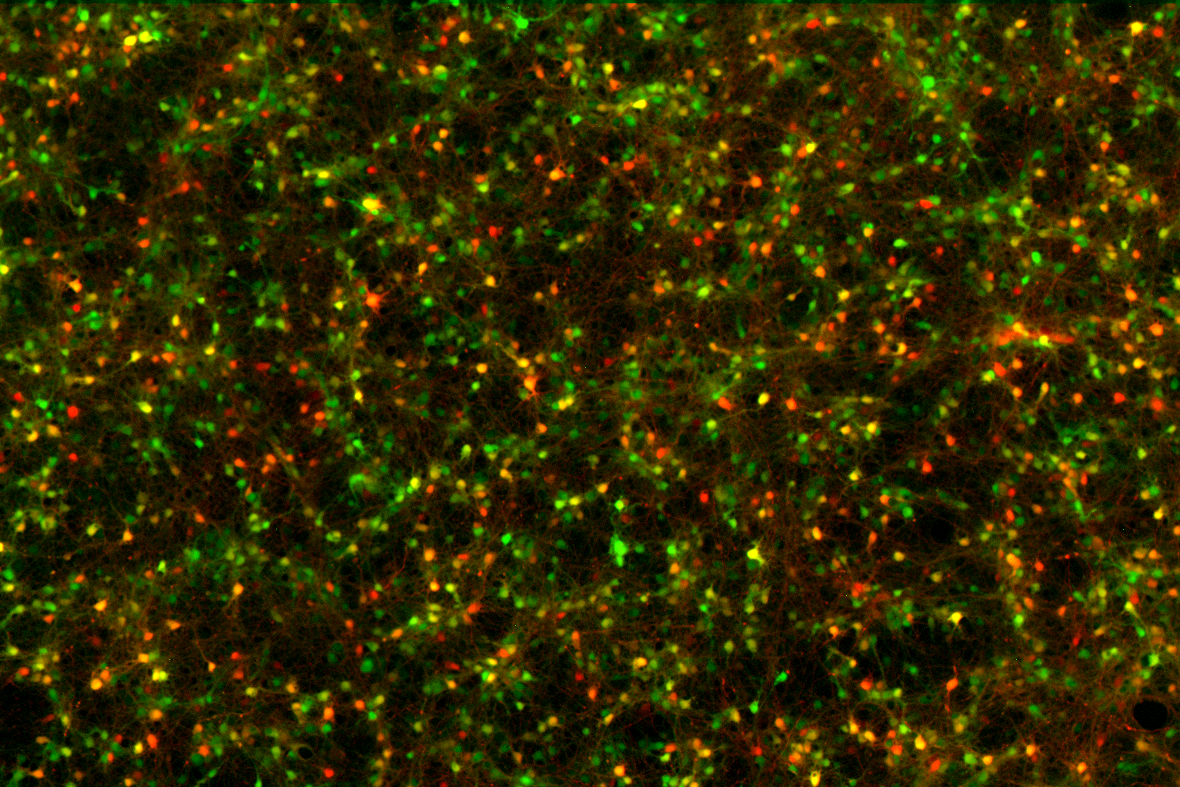 Microscopía de fluorescencia de un cultivo de neuronas, con cuerpos celulares y conexiones en verde, amarillo y rojo