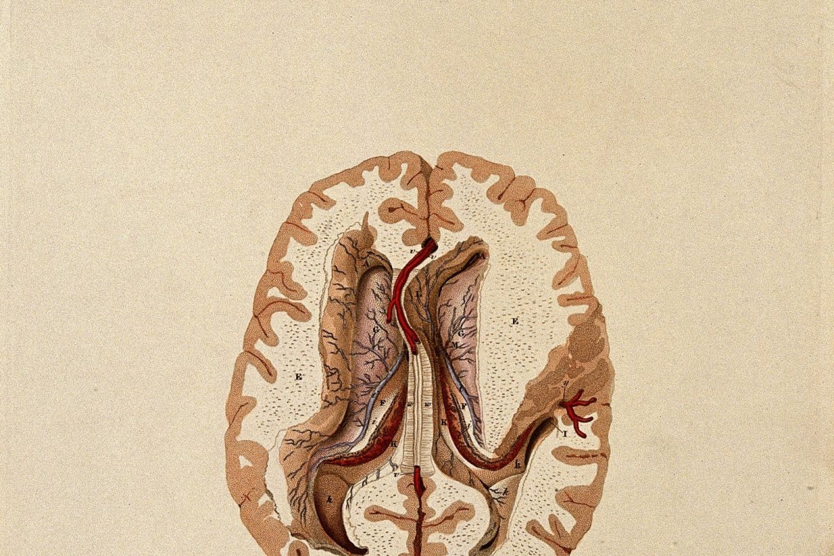 Grabado anatómico coloreado de un corte horizontal del cerebro humano mostrando los ventrículos laterales