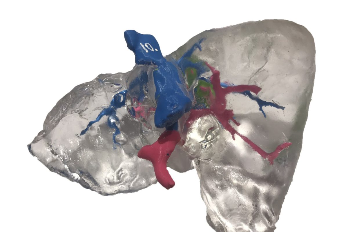 Modelo anatómico de hígado impreso en 3D en material transparente, con los vasos sanguíneos internos señalados en distintos colores