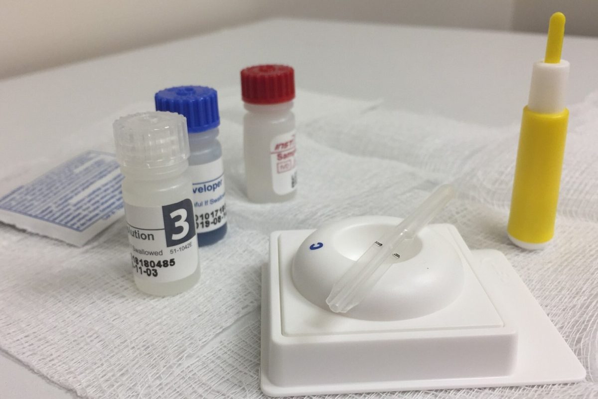 Viales y un dispositivo de análisis de un kit de laboratorio para detectar anticuerpos del VIH sobre una superficie clínica