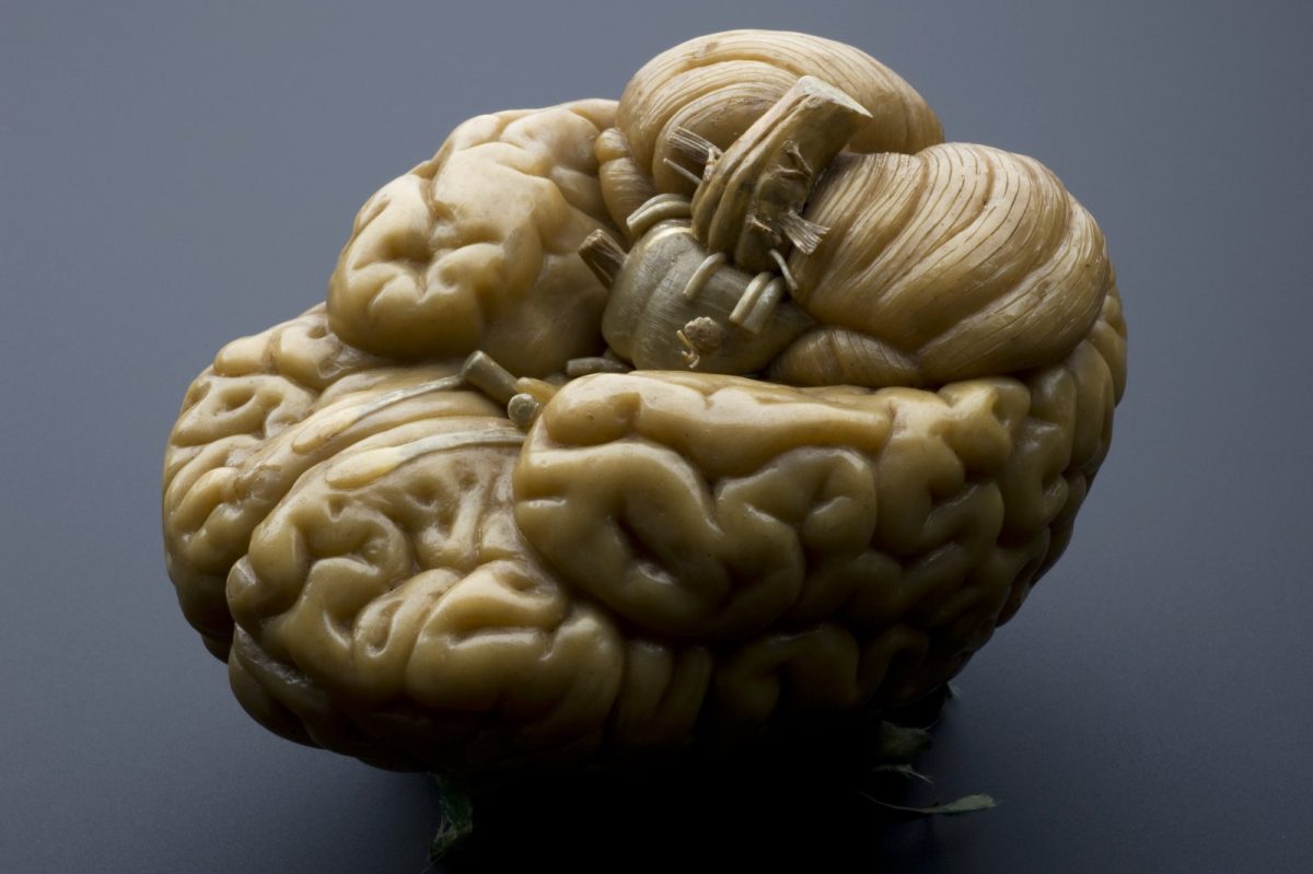 Modelo anatómico de cera de un cerebro humano, usado como material de enseñanza médica, sobre fondo oscuro