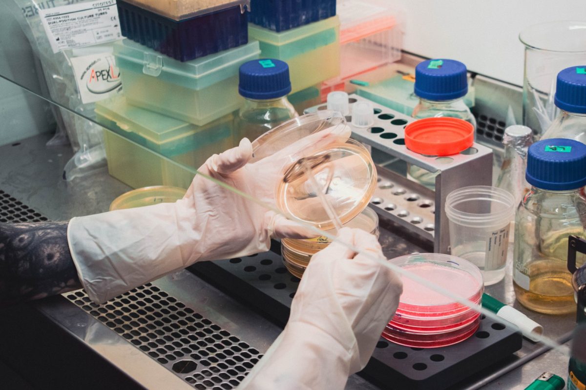 Manos enguantadas manipulando placas de Petri durante un análisis microbiológico de laboratorio