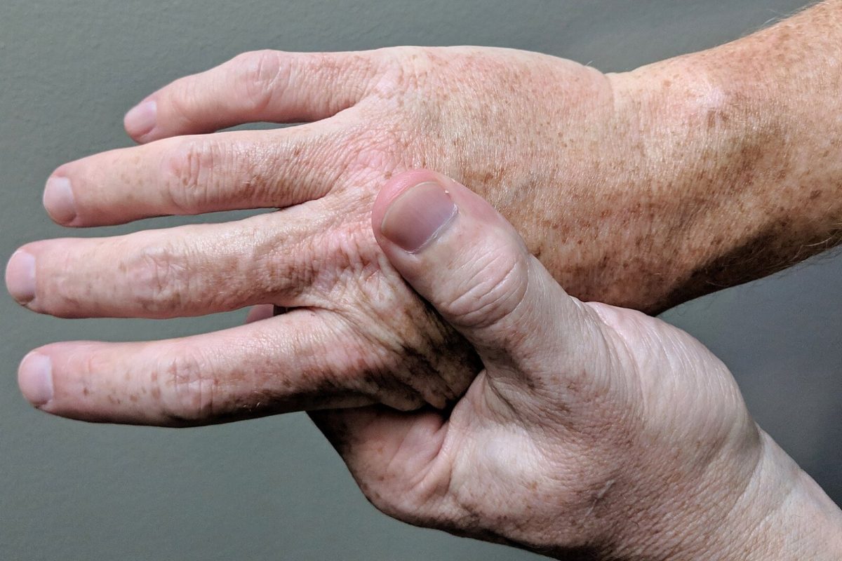 Primer plano de las manos de una persona mayor, una sujetando la otra por la zona del pulgar, con signos de artritis