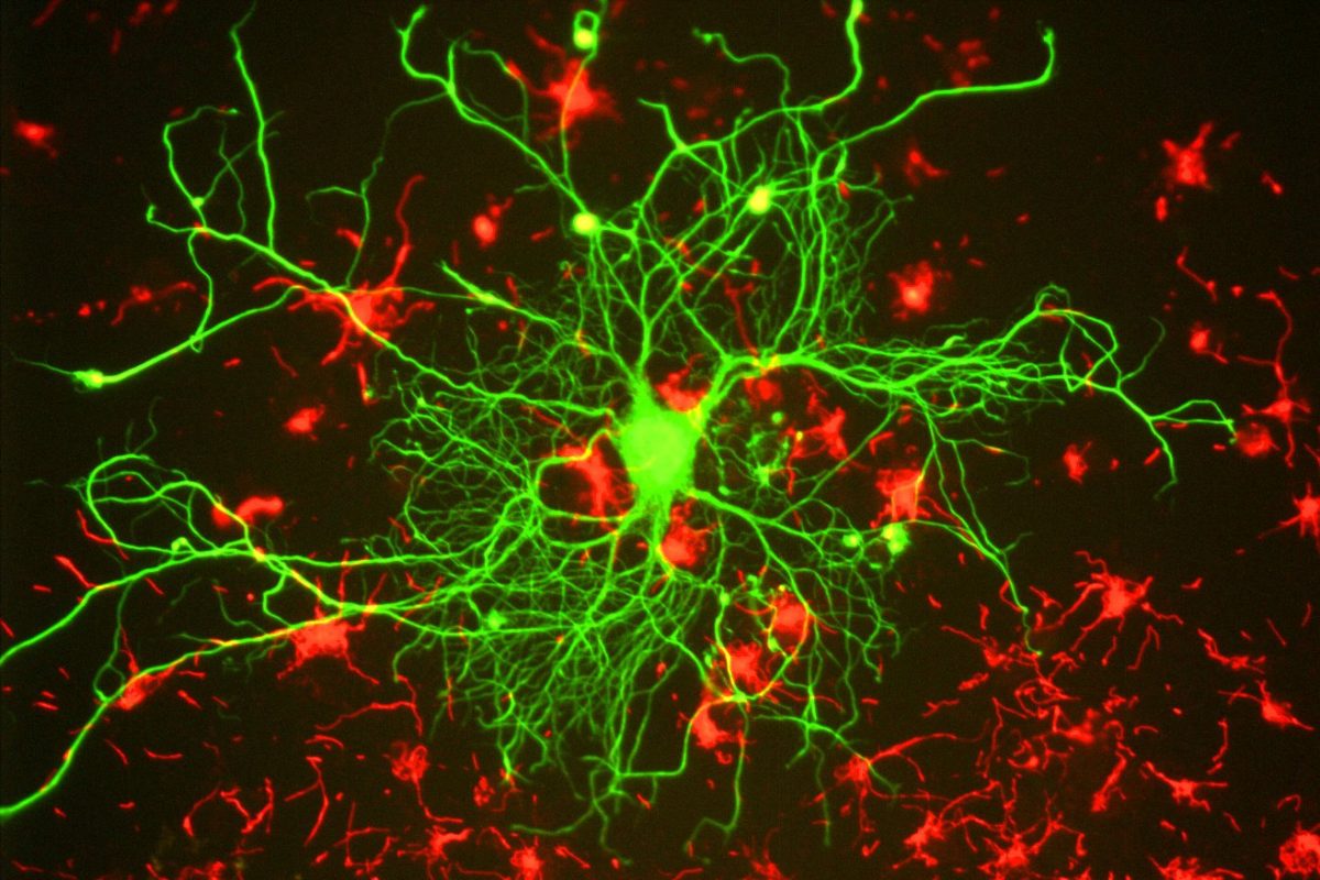 Imagen de microscopía de fluorescencia de una neurona cortical cuyas prolongaciones se ramifican en verde sobre un fondo oscuro, rodeada de células gliales marcadas en rojo