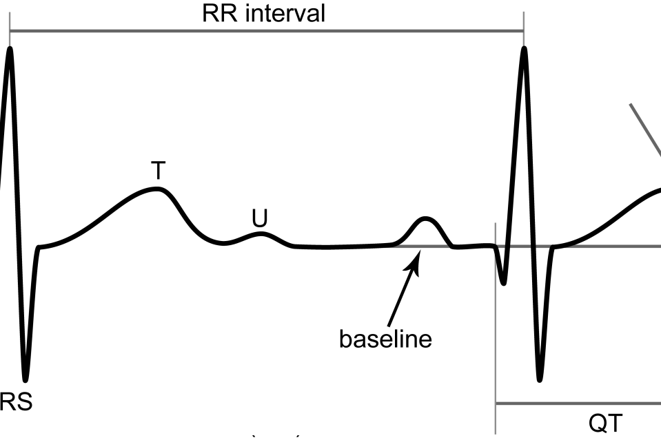 Diagrama de un trazado de electrocardiograma que muestra las ondas P, QRS, T y U, la línea de base, el intervalo RR y la medición del intervalo QT mediante el método de la tangente.