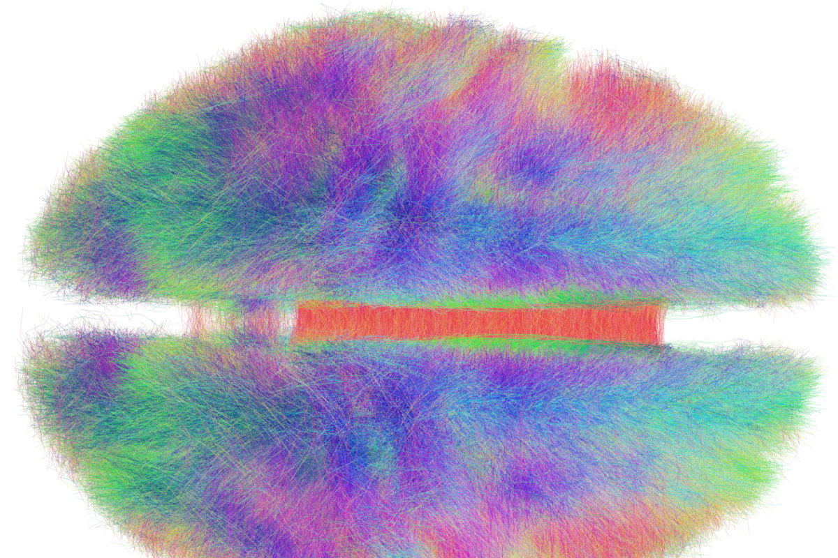 Reconstrucción por tractografía del conectoma humano: miles de fibras de materia blanca del cerebro coloreadas según su dirección, con la banda roja central del cuerpo calloso que une ambos hemisferios.