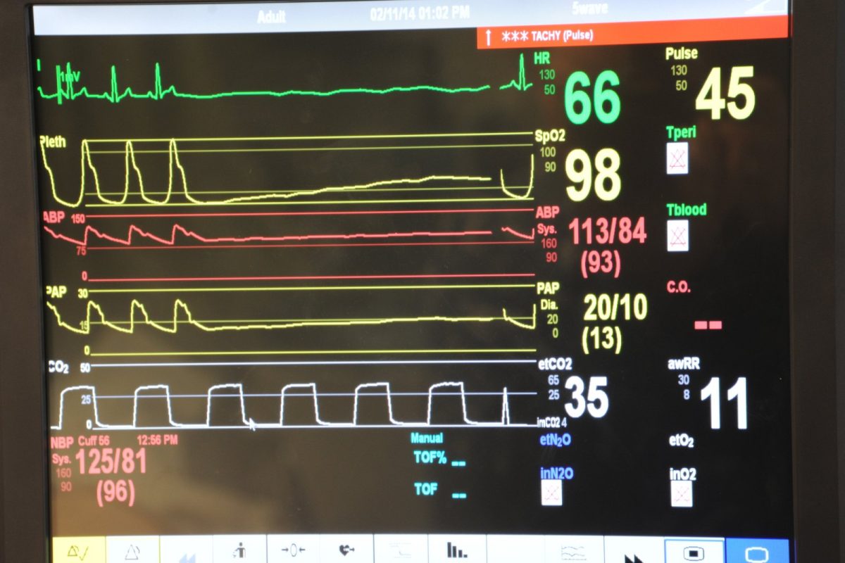 Primer plano de un monitor hospitalario de cabecera que muestra en tiempo real el trazado del electrocardiograma, la saturación de oxígeno y la presión arterial