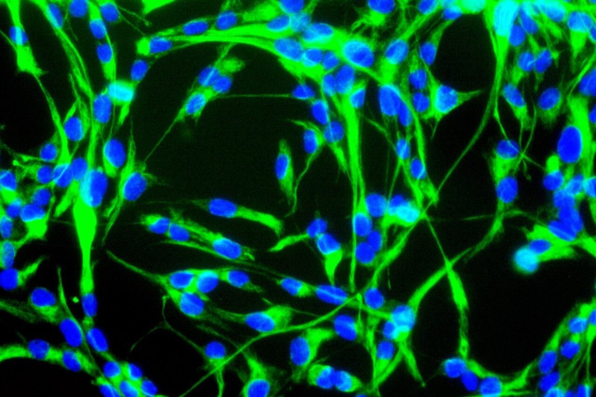 Microfotografía de fluorescencia de células madre neurales en cultivo, con núcleos azules y prolongaciones verdes