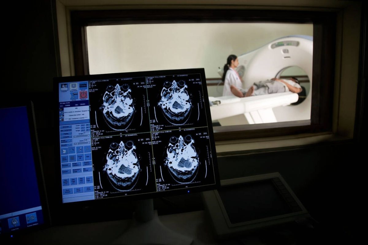 Monitor con cuatro cortes de una tomografía cerebral y, al fondo, una paciente en el escáner