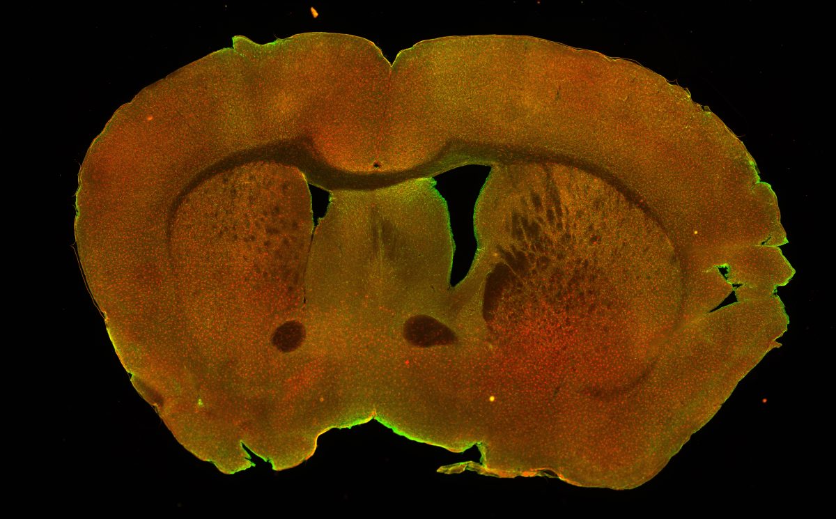 Coronal section of a mouse brain under the microscope with fluorescent staining